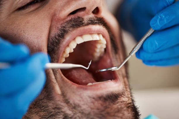 Best Walk-In Dentist Near Me  in Huber Ridge, OH
