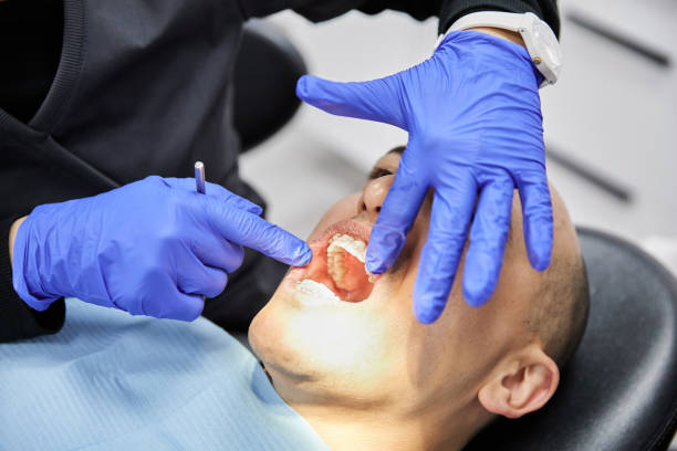 Best Knocked-Out Tooth Emergency  in Huber Ridge, OH