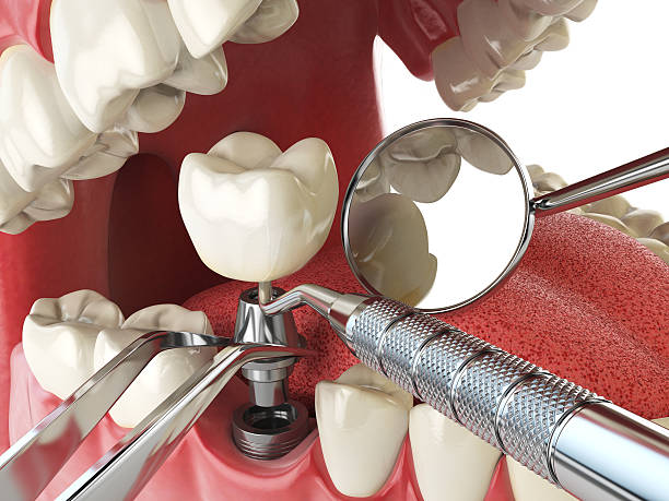 Best Tooth Pain Emergency Relief  in Huber Ridge, OH